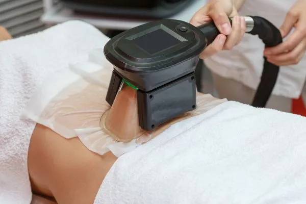 Image of person having fat freezing treatment to help weight gain Sparkhill