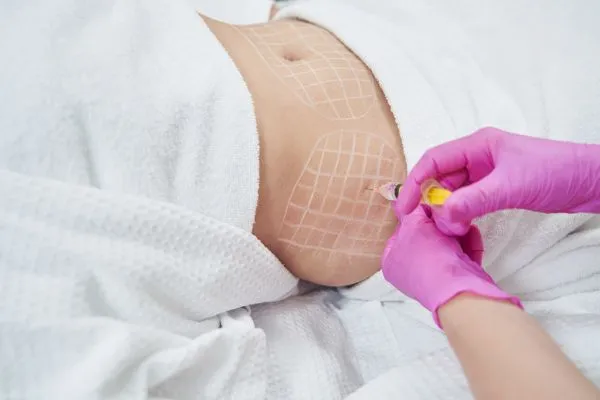 image of fat dissolving injections on love handles to help combat weight gain Sparkhill